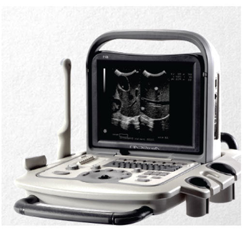 Full Digital Portable Ultrasound Machine - mediniaga